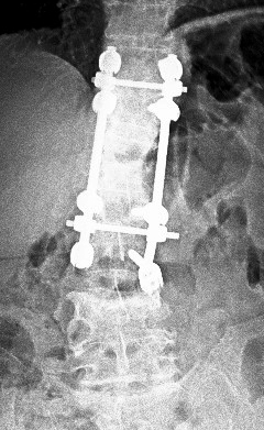 Olgu-2023-07-Direkt-AP