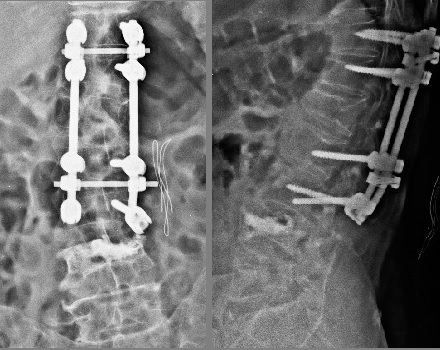Olgu-2023-07-Direkt-Postop